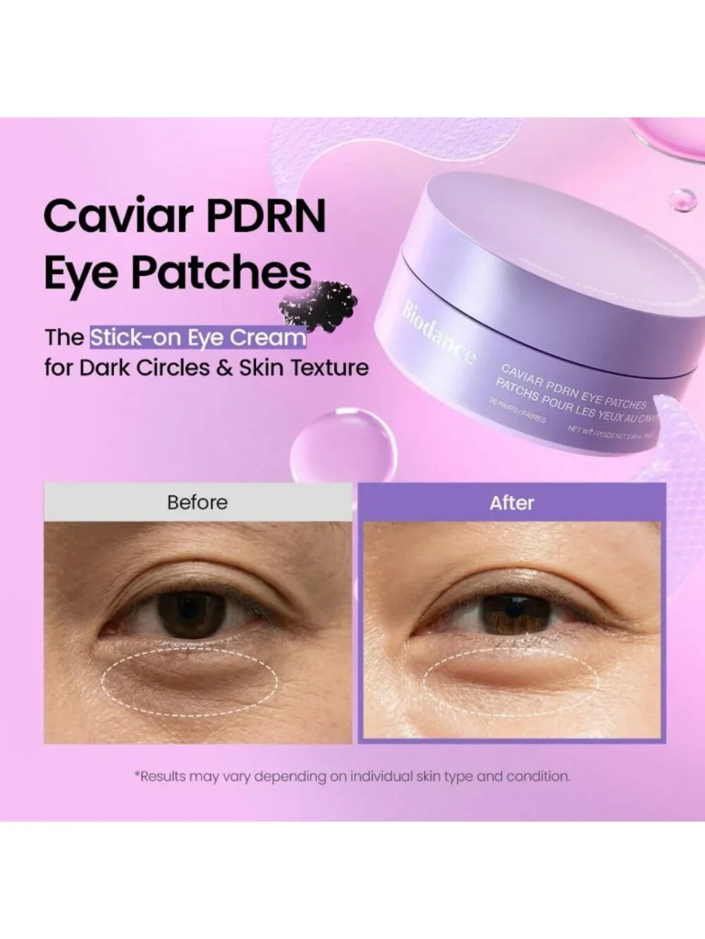 Hydrogel Eye Patches for Dark Circles & Puffiness - Caviar Infused, 60 Count